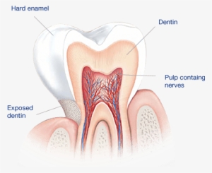 What Causes Sensitive Teeth - Dentes Sensiveis