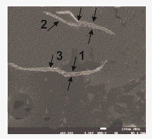 The Sem Picture Of The Suspension Of Amylin, Aggregated - Metal