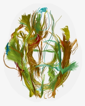 Individually Control The Tract Bundle Colors To Reflect - Illustration