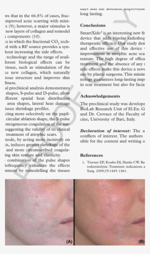 Before And (b) After 6 Month Follow Up - Science