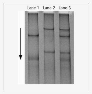Caused By A T C Transition In The Sodium Channel, Voltage-gated, - Monochrome