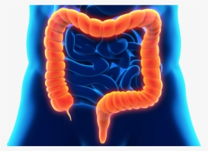 Inflammatory Bowel Disease Dr - Bowl Disease Png