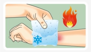 Burns The A To Z Of Rapid Treatment - Burns