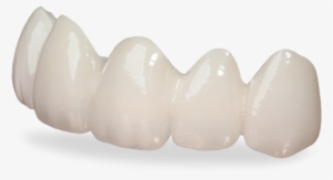 Lava Crowns And Bridges