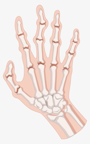 Rheumatoid Arthritis Clip Art - Arthritis Clipart