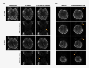 Comparison With The Image-domain Learning - Monochrome