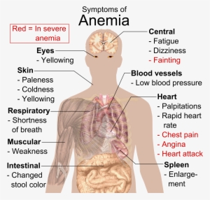 Symptoms Of Anemia - Know If You Re Anemic