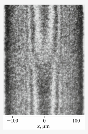 Fragment Of Experimental Section Topogram For The 220 - Scarf