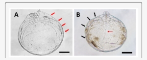 Tritonymph And Deutonymph Of Ophioptes Ekans Sp - Circle