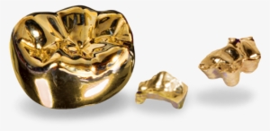 Pfm Lab Outsourcing Services - Cast Restorations