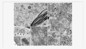 Effect Of Wortmannin On Mvbs In Chara Internodal Cells - Chara