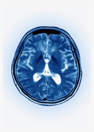 Brain Scan - Computed Tomography