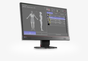 Acquisition And Diagnostic Software For X-ray Images - Computer Monitor