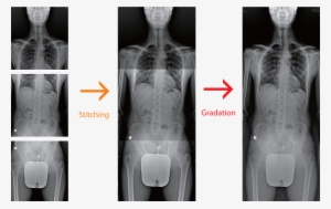 Adding Annotation Text, Graphics And Electronic Markers - X Ray Stitching