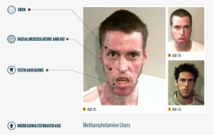 The Affects Of Meth - Meth Addict