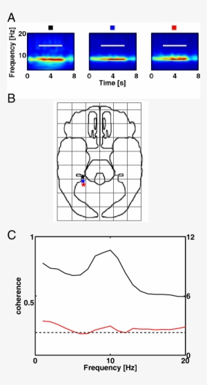 Theta Coherence Shows Local Variability Between Depth - Diagram