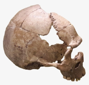 Rhünda Skull