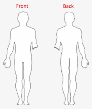 He Is Currently Lacking One Arm That Was Severed In - Primary Tumor