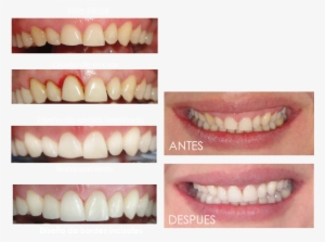 Como En Toda Obra De Arte La Capacidad Artística Del - Design