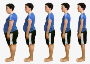 Obesity PNG, Free HD Obesity Transparent Image - PNGkit