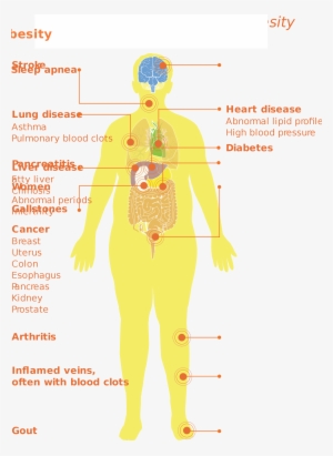 Open - Medical Complications Of Obesity