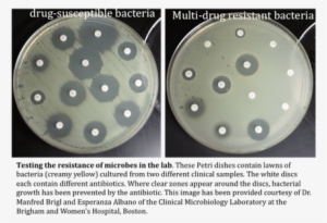 Bacterial Resistance Arises Through The Simple Process - Antibiotic Resistance Petri Dish