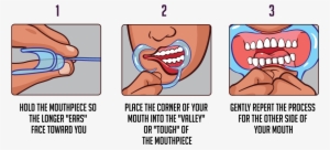 How To Clean Your Mouth Pieces - Watch Your Mouth Instructions