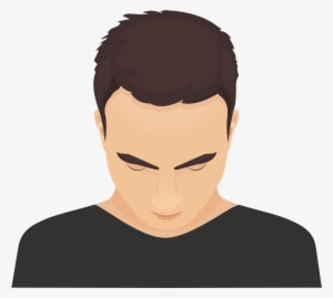 Type 1 - - Pattern Hair Loss