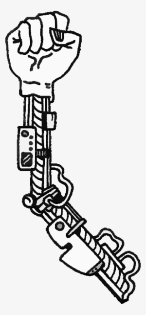 Surgeons Basically Dissect The Shoulder To Access The - Bionic Arm Clip Art