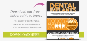 Anchorage Dentist - Dental Implant Offers