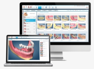 Dental Software Free Download - Chairside Dental