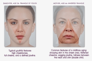 Mother And Daughter, Side By Side, Shows How The Contour - Face