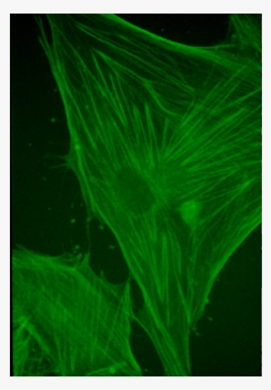 Mouse - Anti-actin Antibodies