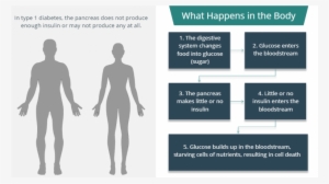 Absolute Size Of Gru