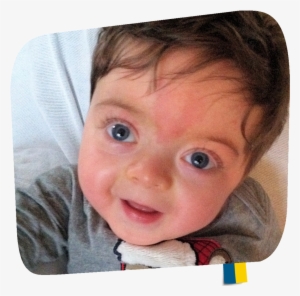 Asxl2 - 01a - Additional Sex Combs Like 2, Transcriptional Regulator