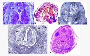 View Larger Version - Computed Tomography