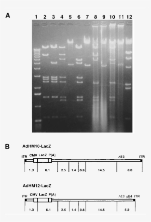 Restriction Endonuclease Analysis - Number