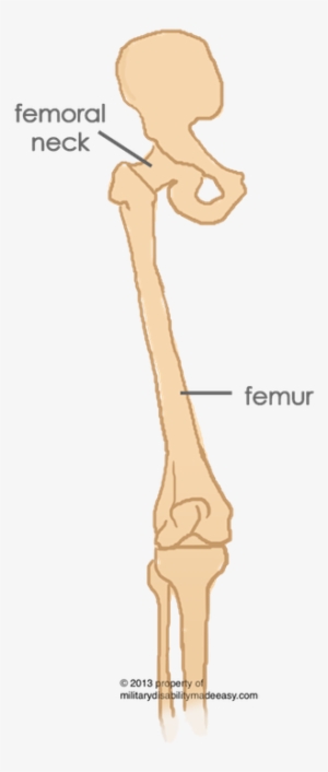Parent Directory - Femur