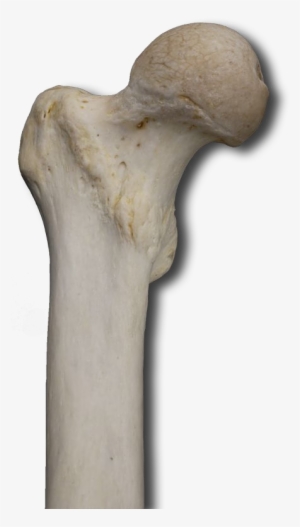 Proximal Anterior - Wood