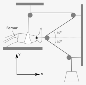 Femur 30° 30° - Force