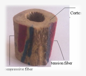 The Rockwell 'c' Test Has Been Conducted On Three Major - Mechanical Load Of Femur