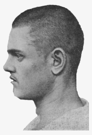 Epilepsy, Age - Profile Face Png