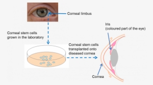 Stem Cell In Eye