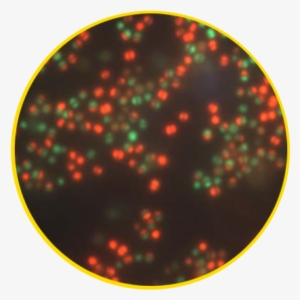 Staphylococcus Aureus