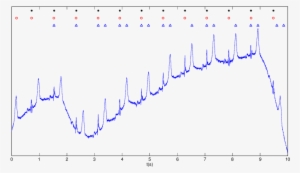 Ten Seconds Of Avl Lead Of Record S0131lrem - Calligraphy
