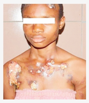 Health Worker Arrested For Inflicting Injuries