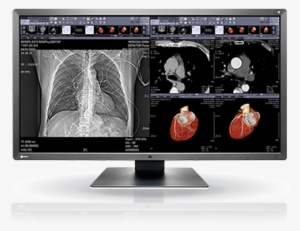 Mx315w - Eizo Mx315w
