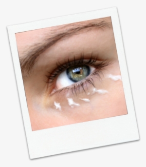 Dark Eye Circles - Cream