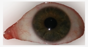 8796667 - >> - Close-up