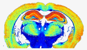 Article Update 82cf82e6 D658 45c5 A505 Adb114d9fdf4 - Brain